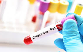 Bu gün Azərbaycanda 5811 nəfər koronavirus testindən keçib