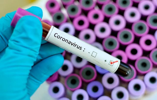 Ermənistanda daha 10 nəfər koronavirusdan öldü