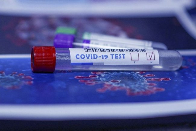 Gürcüstanda son sutkada koronavirusa daha 14 yoluxma qeydə alınıb