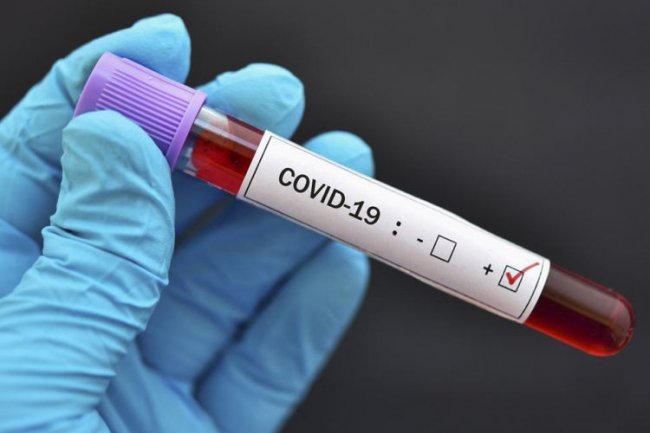 Gürcüstanda fevraldan bəri koronavirusa ən çox yoluxma qeydə alınıb