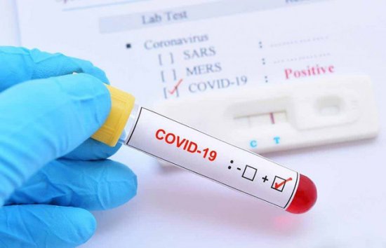 Nepalda koronavirusdan ilk ölüm qeydə alınıb