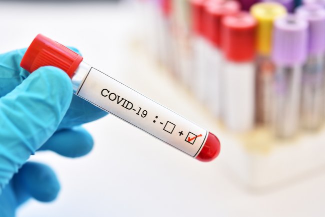 Koronavirus testlərinin sayı 200 mini keçdi