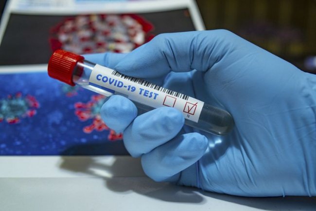 Qərargah: Koronavirusa yoluxan 3518 nəfərdən 2198-i sağalıb, 41 nəfər vəfat edib