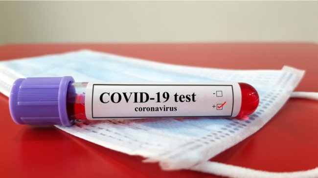 Koronavirus testindən keçmək istəyənlərə müraciət edildi