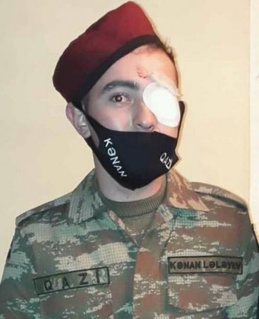 "Ağstafa rayon İcra Hakimiyyətindən bir nəfər gəlib qapımızı açıb deməyib ki..." - Gözünü itirmiş Qazimizdən ETİRAZ "Ağstafa rayon İcra Hakimiyyətindən bir nəfər gəlib qapımızı açıb deməyib ki..." - Gözünü itirmiş Qazimizdən ETİRAZ